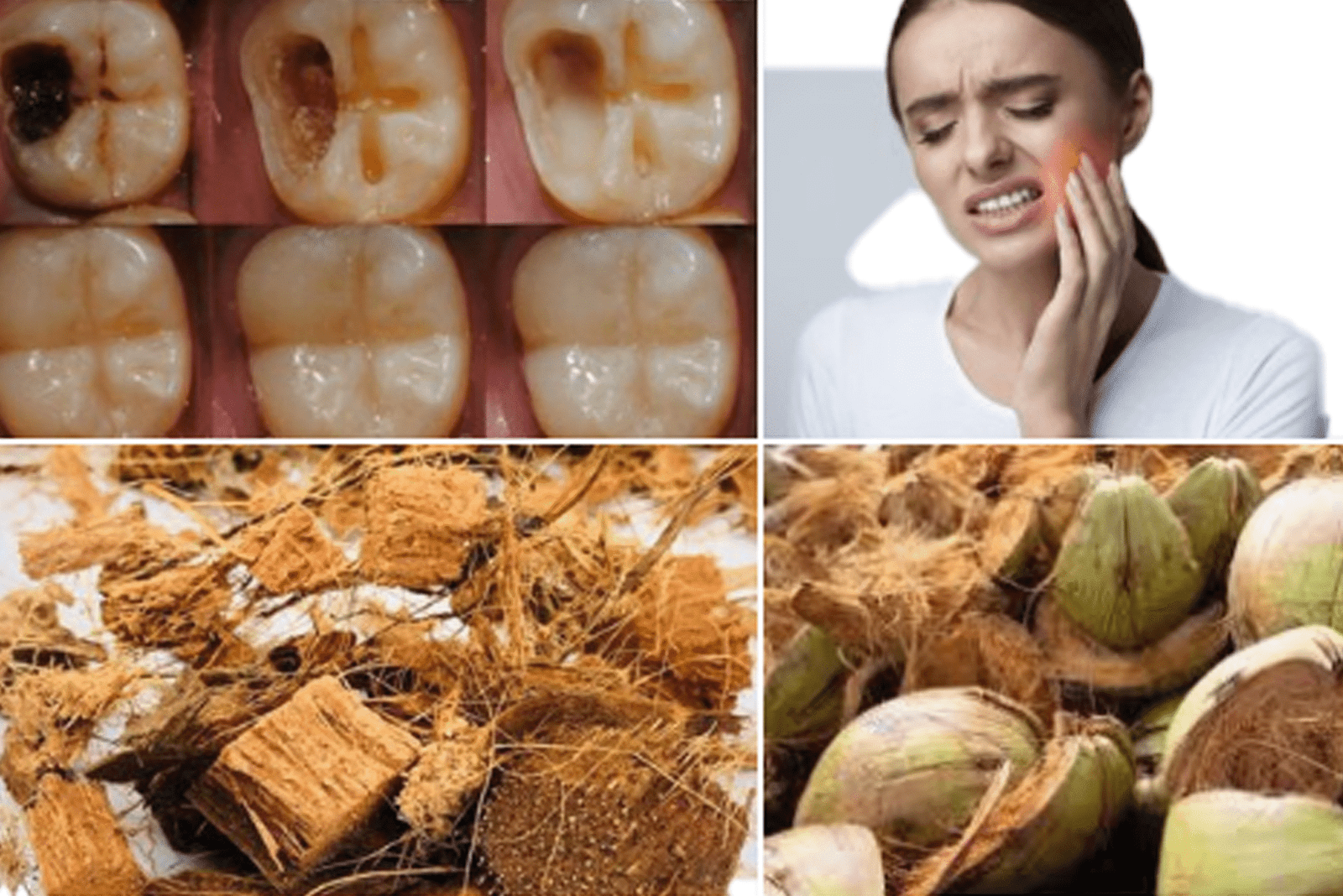 🥥 Coconut Husk Remedy for Toothaches: Nature’s Powerful Pain Relief